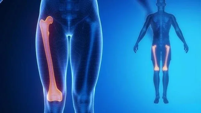 Fratura do fêmur em idosos Prevenção e Tratamento