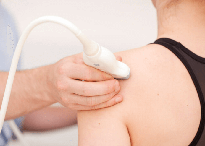 ultrassom de ombro,diagnóstico de bursite